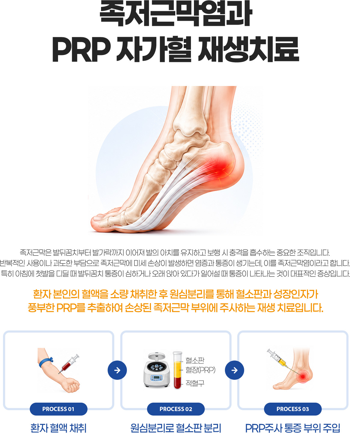 �����ٸ����� PRP �ڰ��� ���ġ��